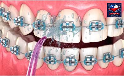 Irrigador bucal Portátil Oral